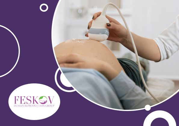 Ersatzmutter Niederlande Preis