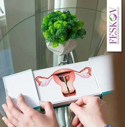 imsi icsi-Unterschied