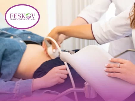 Der Ultraschallarzt f&uuml;hrt nach der Implantation des Embryos, der einer PGT-A-Genetiktestung unterzogen wurde, eine Nachuntersuchung mittels Ultraschall durch.